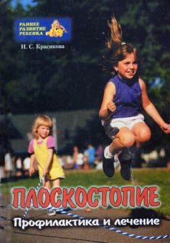 Читайте книги онлайн на Bookidrom.ru! Бесплатные книги в одном клике Ирина Красикова - Плоскостопие у детей