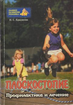 Читайте книги онлайн на Bookidrom.ru! Бесплатные книги в одном клике Ирина Красикова - Плоскостопие у детей