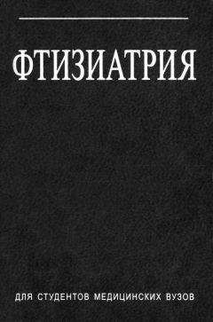 Читайте книги онлайн на Bookidrom.ru! Бесплатные книги в одном клике Илья Гельберг - Фтизиатрия