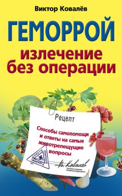 Читайте книги онлайн на Bookidrom.ru! Бесплатные книги в одном клике Виктор Ковалев - Геморрой. Излечение без операции