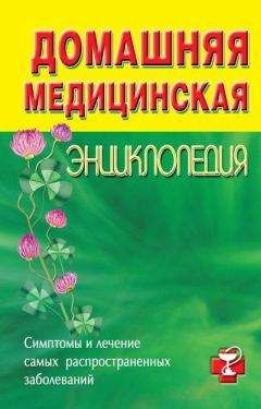 Читайте книги онлайн на Bookidrom.ru! Бесплатные книги в одном клике Коллектив авторов - Домашняя медицинская энциклопедия. Симптомы и лечение самых распространенных заболеваний