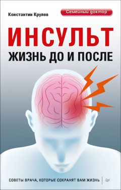 Читайте книги онлайн на Bookidrom.ru! Бесплатные книги в одном клике Константин Крулев - Инсульт. Жизнь до и после