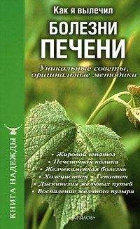 Читайте книги онлайн на Bookidrom.ru! Бесплатные книги в одном клике П. Аркадьев - Как я вылечил болезни печени. Уникальные советы, оригинальные методики