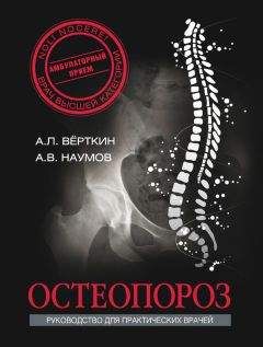 Читайте книги онлайн на Bookidrom.ru! Бесплатные книги в одном клике Антон Наумов - Остеопороз