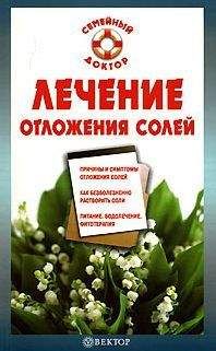 Читайте книги онлайн на Bookidrom.ru! Бесплатные книги в одном клике Ирина Калюжная - Лечение отложения солей