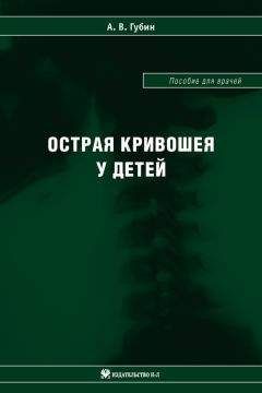 Читайте книги онлайн на Bookidrom.ru! Бесплатные книги в одном клике Александр Губин - Острая кривошея у детей: Пособие для врачей