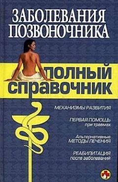 Читайте книги онлайн на Bookidrom.ru! Бесплатные книги в одном клике Коллектив Авторов - Заболевания позвоночника. Полный справочник