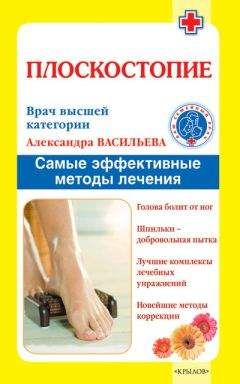 Александра Васильева - Плоскостопие. Самые эффективные методы лечения