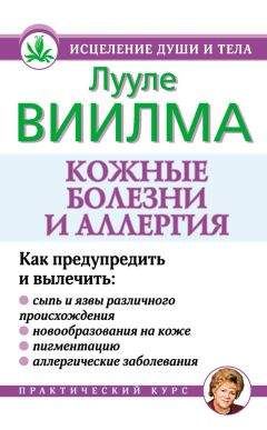 Читайте книги онлайн на Bookidrom.ru! Бесплатные книги в одном клике Лууле Виилма - Кожные болезни и аллергия