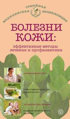 Читайте книги онлайн на Bookidrom.ru! Бесплатные книги в одном клике Елена Савельева - Болезни кожи: эффективные методы лечения и профилактики
