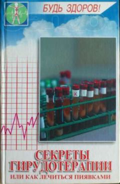 Читайте книги онлайн на Bookidrom.ru! Бесплатные книги в одном клике Денис Жаров - Секреты гирудотерапии