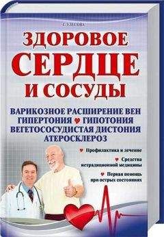 Читайте книги онлайн на Bookidrom.ru! Бесплатные книги в одном клике Галина Улесова - Здоровое сердце и сосуды