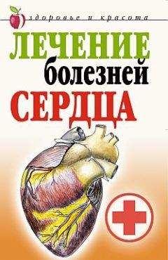 Читайте книги онлайн на Bookidrom.ru! Бесплатные книги в одном клике Татьяна Гитун - Лечение болезней сердца
