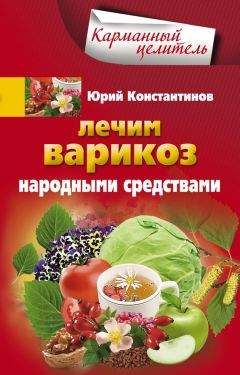 Читайте книги онлайн на Bookidrom.ru! Бесплатные книги в одном клике Юрий Константинов - Лечим варикоз народными средствами