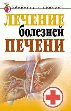 Читайте книги онлайн на Bookidrom.ru! Бесплатные книги в одном клике Татьяна Гитун - Лечение болезней печени