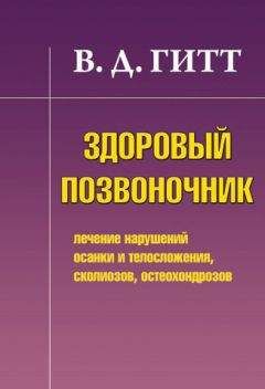 Читайте книги онлайн на Bookidrom.ru! Бесплатные книги в одном клике Виталий Гитт - Здоровый позвоночник. Лечение нарушений осанки и телосложения, сколиозов, остеохондрозов