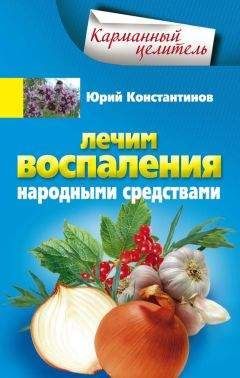 Читайте книги онлайн на Bookidrom.ru! Бесплатные книги в одном клике Юрий Константинов - Лечим воспаления народными средствами