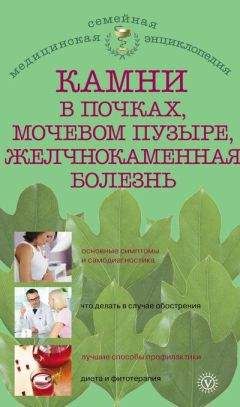 Александра Васильева - Камни в почках, мочевом пузыре, желчнокаменная болезнь