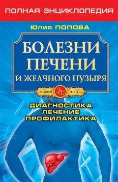 Читайте книги онлайн на Bookidrom.ru! Бесплатные книги в одном клике Юлия Попова - Болезни печени и желчного пузыря. Диагностика, лечение, профилактика